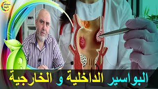 علاج طبيعي لكل أنواع البواسير في المنزل   -   الدكتور كريم العابد العلوي   -