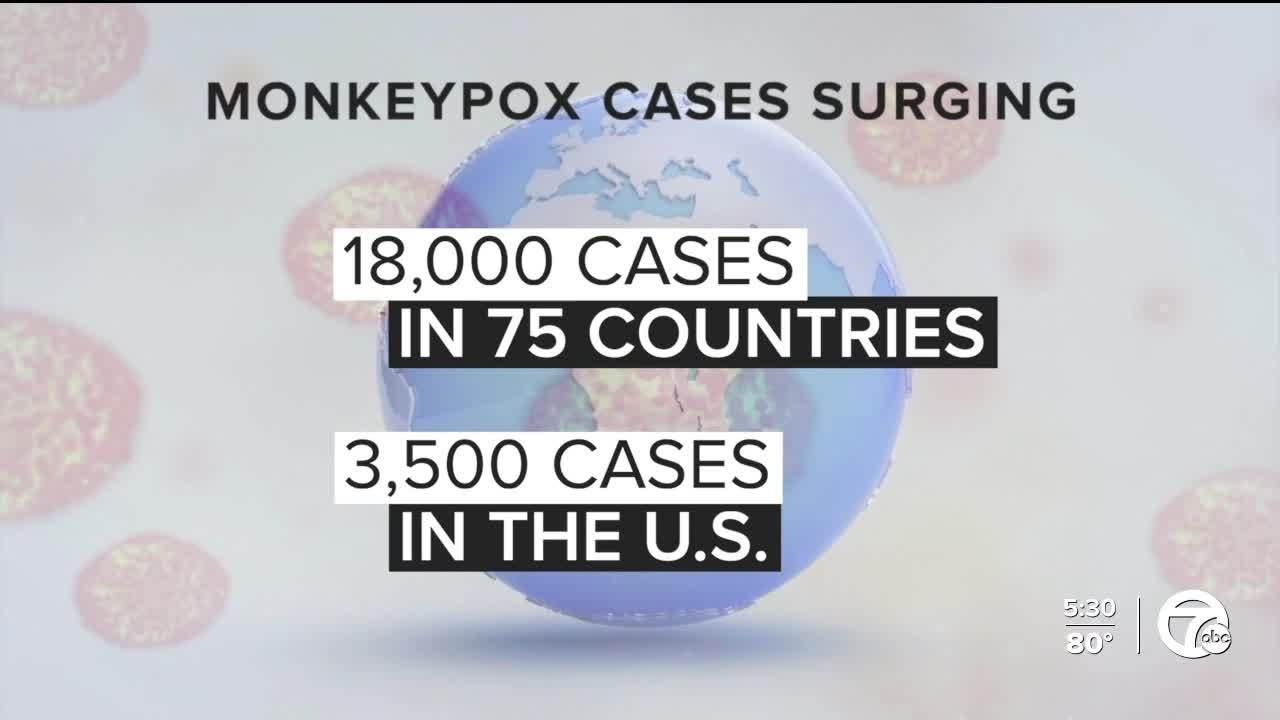US monkeypox cases are among the highest in the world, CDC says - YouTube