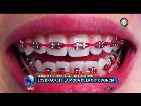 Porque ponen gomas brackets