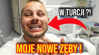 LICÓWKI W TURCJI - MOJE NOWE ZĘBY !