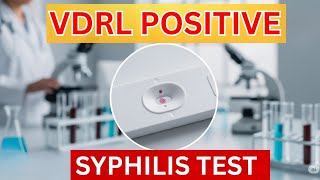 VDRL TPHA Positive Treatment in Urdu Hindi | Vdrl Test Kya Hota Hai | VDRL Negative Kaise hota hai