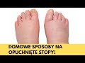 Opuchnite stopy i nogi s na to domowe sposoby  sprawd