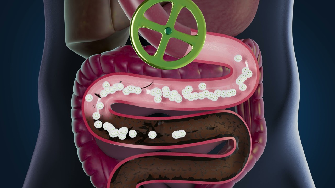 ProCombo Intestine Cleanup HD x264