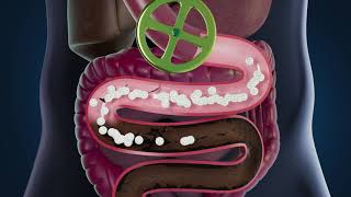 ProCombo Intestine Cleanup HD x264