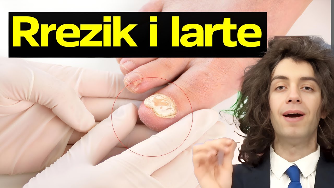 KUJDES/ Elementi numër një ushqimor që SHKAKTON MYK, zbulojeni tani