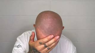 Shiny Scalp? Try This I Meet Matte Look