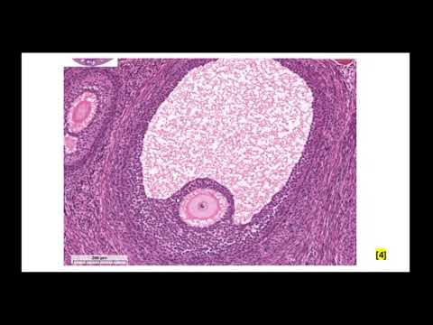 ЖПС. Особенности овогенеза. Препарат яичник и фолликулогенез. Стадии развития желтого тела.