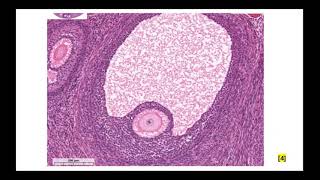 ЖПС. Особенности овогенеза. Препарат яичник и фолликулогенез. Стадии развития желтого тела.