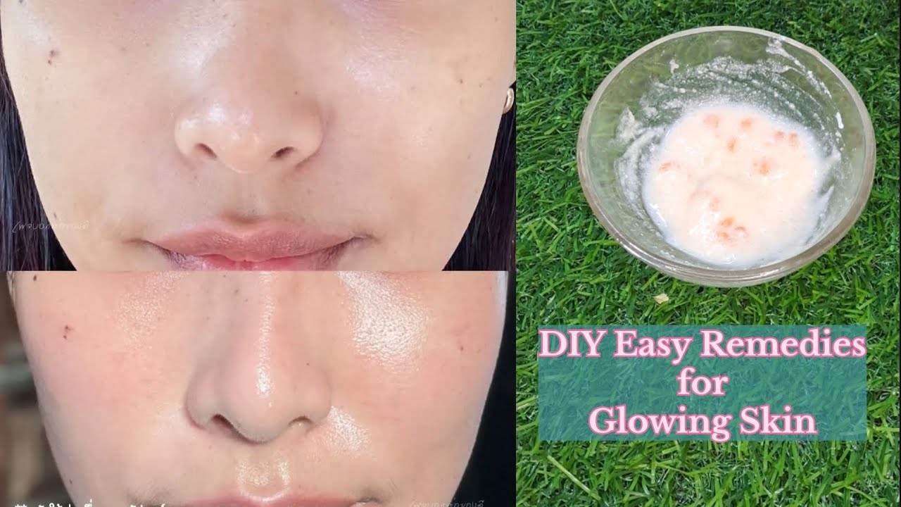 DIY Easy Remedies for Glowing Skin #skincare #glowingskin - YouTube
