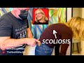 SCOLIOSIS ~ CHIROPRACTIC DELIVERS SOME RELIEF!