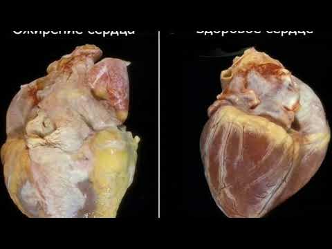 Интересные факты о сердце человека.