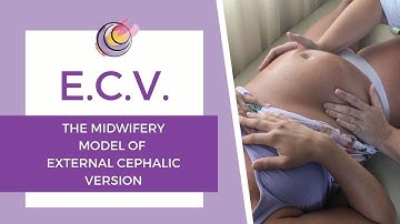 Hands On Example of The Midwifery Model Of External Cephalic Version