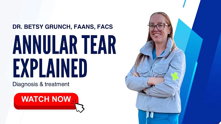 Case study 120 - Annular Tear EXPLAINED by Dr. Grunch, board-certified neurosurgeon