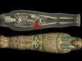 X Ray Reveals Shocking Discovery Inside 2,000 Year Old Mummy!