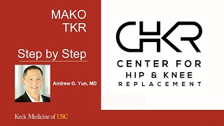 Mako Total Knee Replacement Step By Step