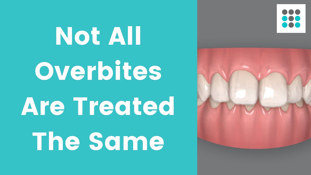 NOT ALL OVERBITES ARE TREATED THE SAME l Dr. Melissa Bailey Orthodontist