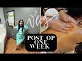 VLOG: One week post op Lipo appointment!