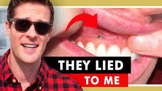 My Turkey Teeth Implants Nightmare - I did my research