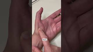 Lung meridian points. Lung 10