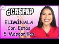 5 REMEDIOS CASEROS PARA QUITAR LA CASPA (Rápidamente y Para Siempre)