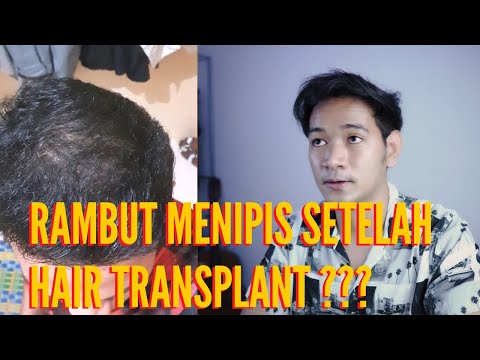 Video: Bagaimana Dan Kapan Lebih Baik Untuk Transplantasi Plum?