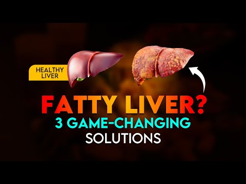 Fatty Liver: 3 GAME-CHANGING Solutions [Coffee, Fiber, Mediterranean Diet]