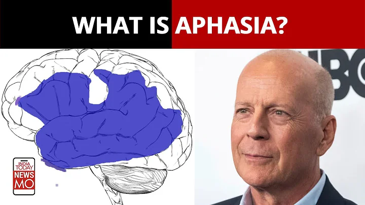 Bruce Willis Diagnosed With Aphasia, Announces Retirement, What Is Aphasia And Can It Be Cured?