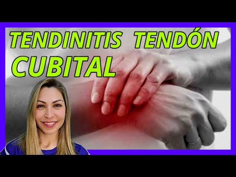👍🏼TENDINITIS CUBITAL de MUÑECA/Dolor muñeca en la parte externa/TRATAMIENTO #fisioterapia