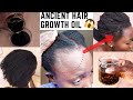THIS OIL WILL GROW YOUR BALDNESS & SLOW HAIR GROWTH 3 TIMES UNSTOPPABLE FASTER.