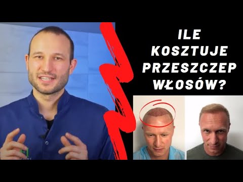 Wideo: Co właściciele muszą wiedzieć o przeszczepach narządów domowych