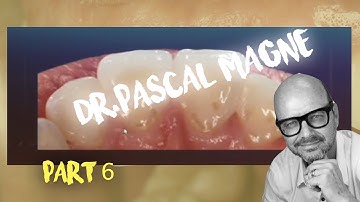 Pascal Magne Part #6