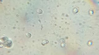 mushroom spores under microscope (1500x,675x,150x) (4k)
