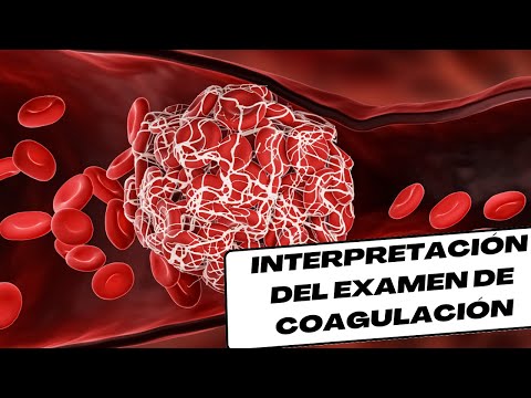 Vídeo: Coagulograma: Que Es Este Análisis, Decodificación De Indicadores, Norma