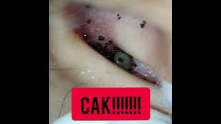 Kutu Babi aka Cekenit Kacau Hari Mama