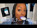 GLEEM WHITENING KIT | RESULTS! | At home whitening UNDER $40!