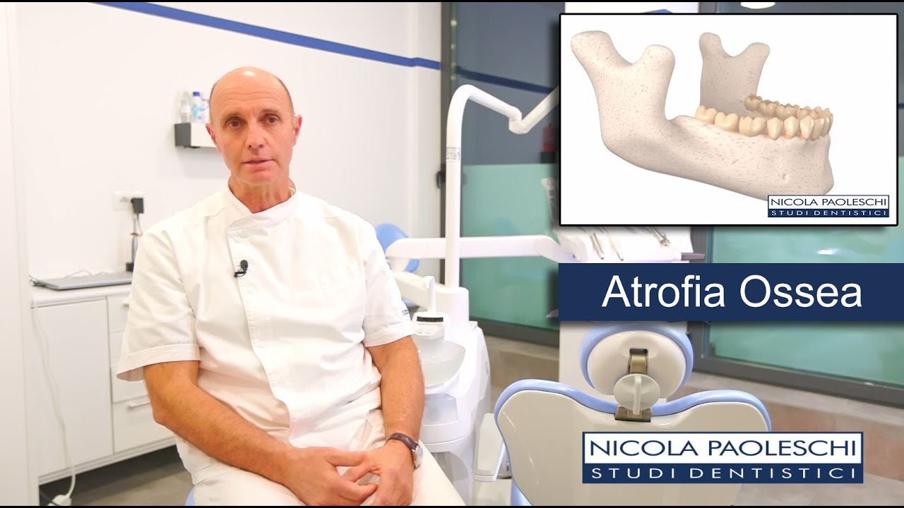 Implantologia dentale nei casi di Grave Atrofia
