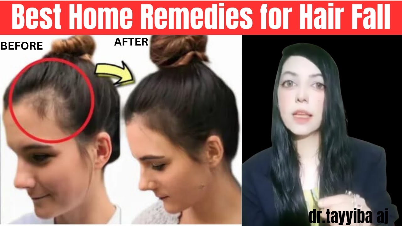 Best home remedy for Hair Loss and regrowth Girte balo ka illaj