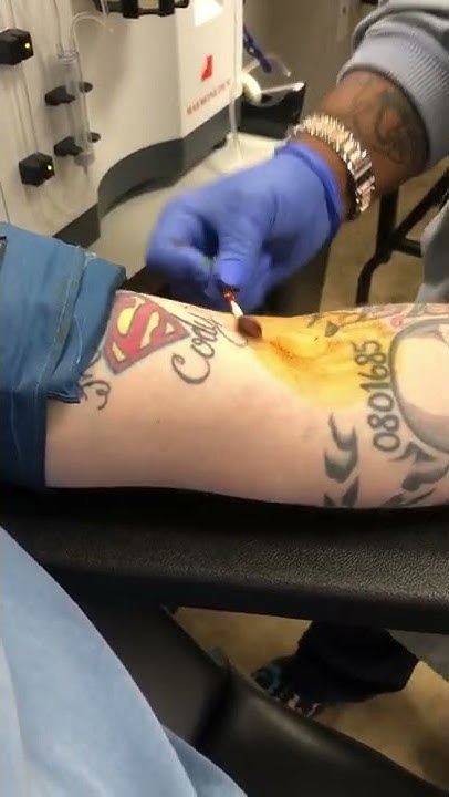 How long after a tattoo can you donate plasma