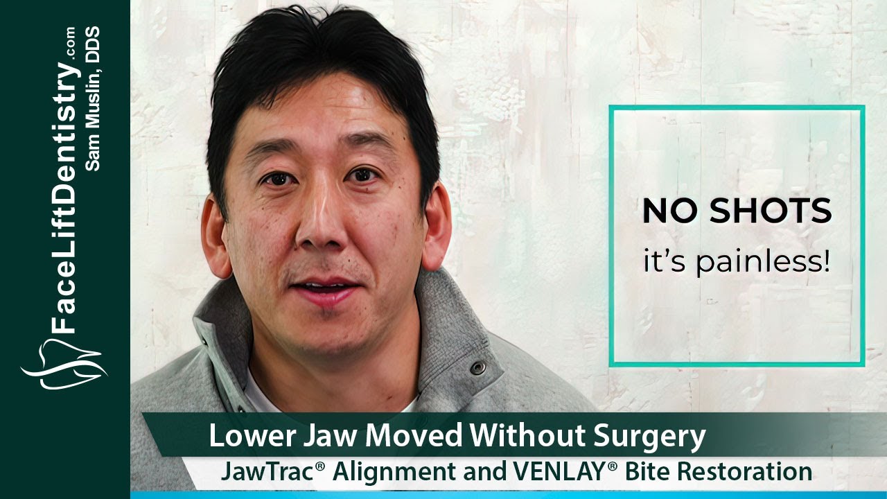 Lower Jaw Repositioned without Surgery using JawTrac® Alignment and