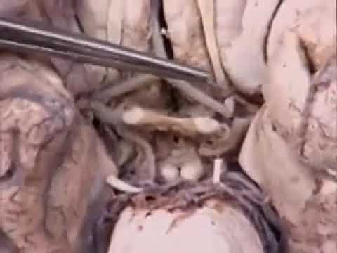 Vidéo: Anatomie, Fonction Et Diagramme De L'artère Communicante Postérieure - Cartes Corporelles