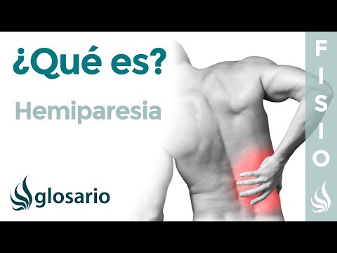 Vídeo: Hemiplejía: Causas, Síntomas Y Tratamiento De La Hemiplejía