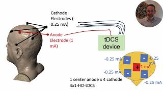 History (and basics) of HighDefinition tDCS (HDtDCS)