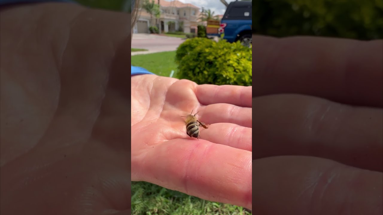Bee Stings Happen On The Daily