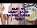 ELIMINA MANCHAS NEGRAS EN CODOS, AXILAS  Y ENTREPIERNAS- SUPER FACIL