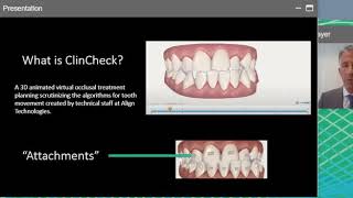 Orthognathic Surgery with Clear Aligners Orthognathic Surgery with Clear Aligners