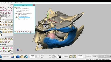 Maxilla Mesh modelling using Geomagic Freeform