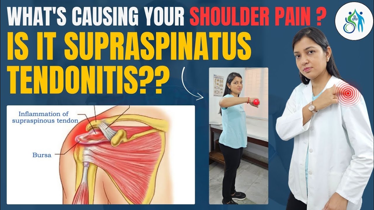 Supraspinatus Tendonitis Shoulder Pain