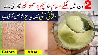 Home Remedies To Get Rid Of Open Pores On Skin || Shrink large pores Naturally At Home screenshot 5