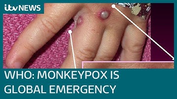 Monkeypox declared global health emergency by World Health Organization | ITV News