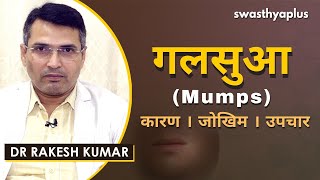 गलसुआ - क्या है कारण, लक्षण और उपचार? | Dr Rakesh Kumar on Mumps in Hindi | Causes & Prevention